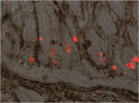Insulin/glucagon in islets of mouse pancreas
