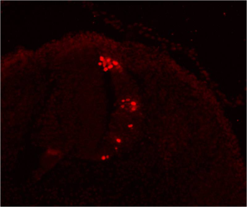 Insulin/glucagon in islets of mouse pancreas